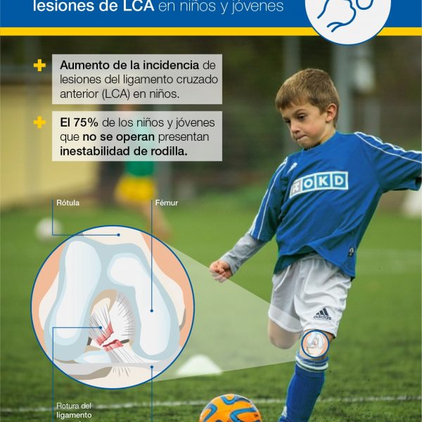 Lesiones LCA en niños