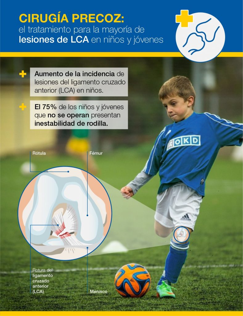 Lesiones LCA en niños