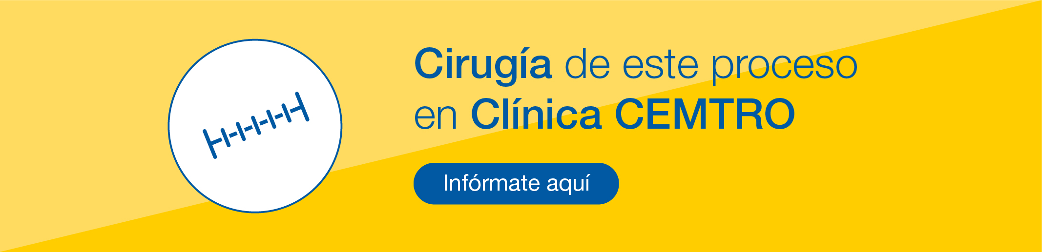 Cirugia Proceso varices