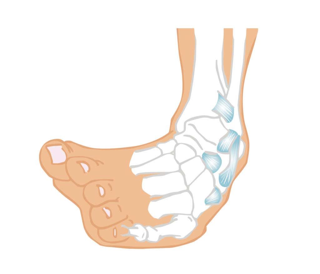 Postoperatorio Inestabilidad Tobillo