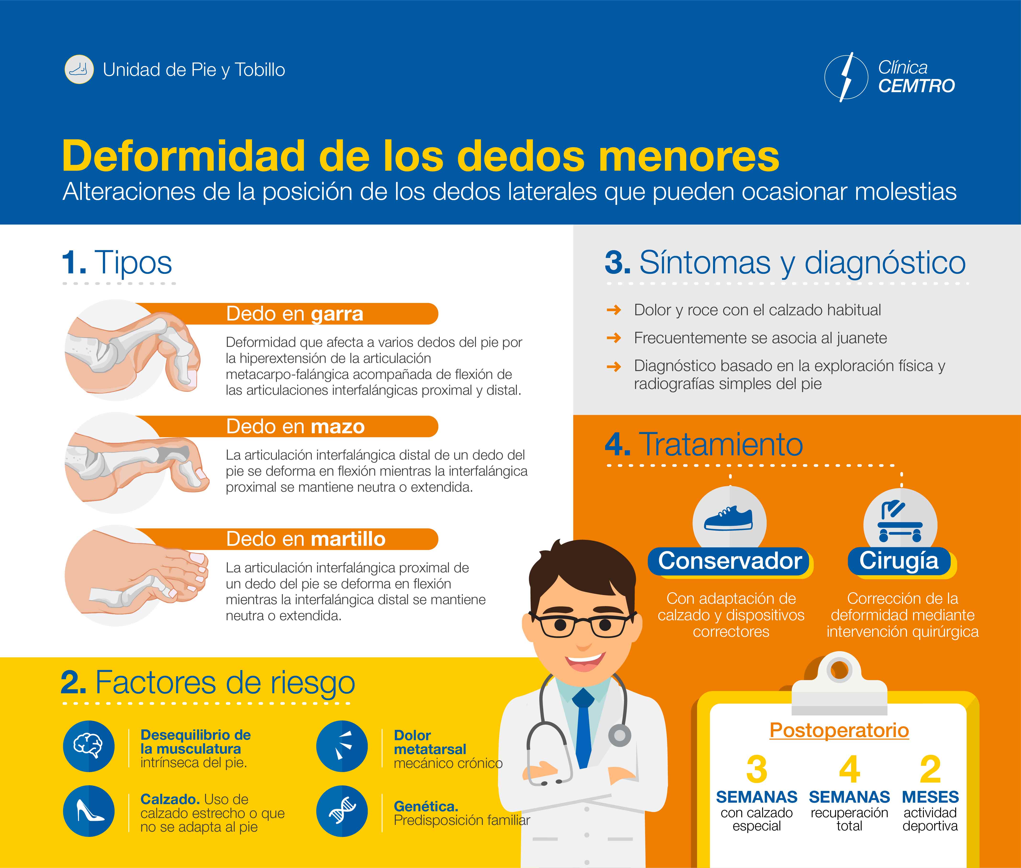 Infografia Dedo Garra Martillo