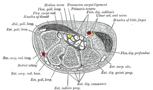 Sindrome del Tunel Carpo