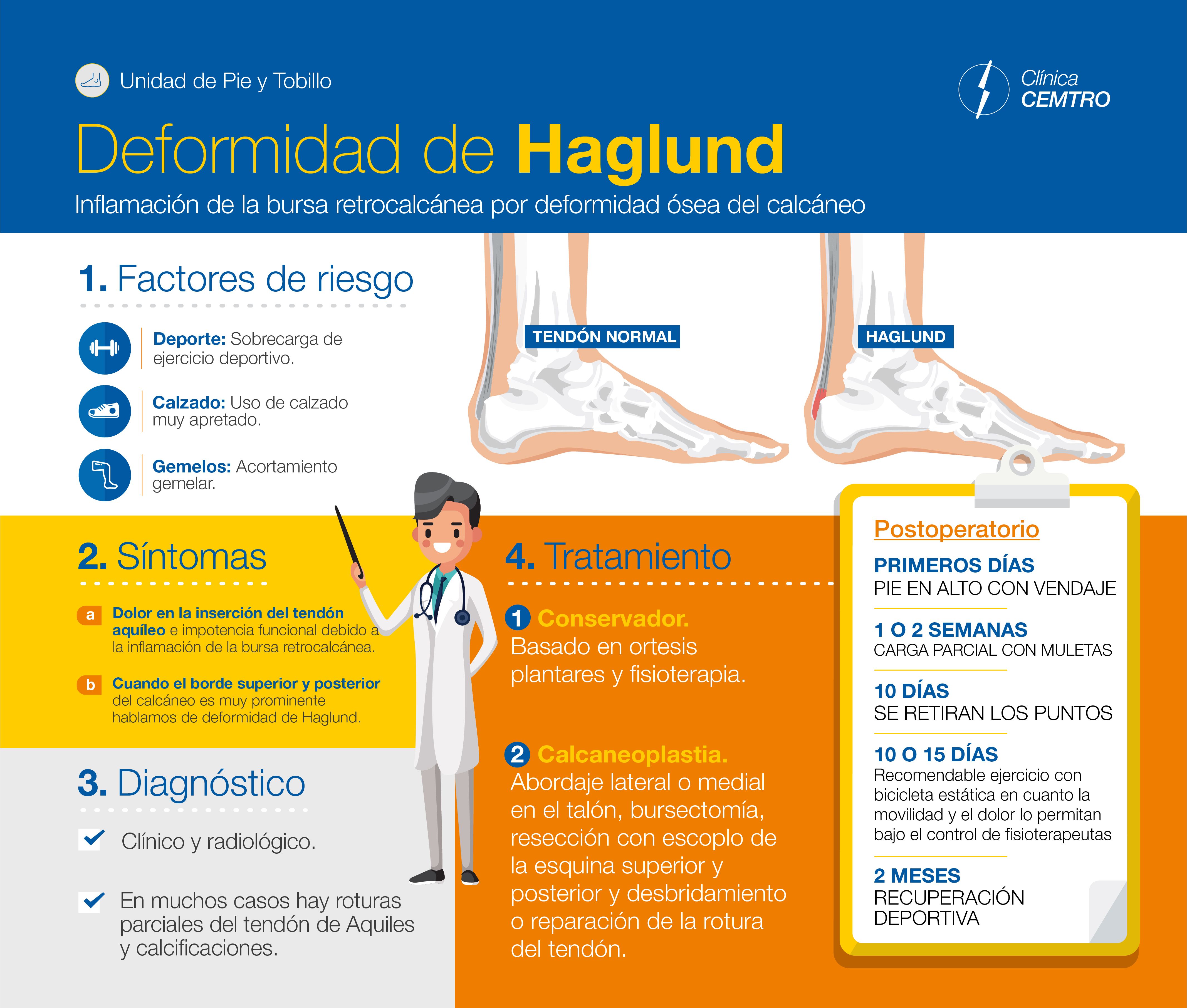 recuperación de la impotencia en bicicleta