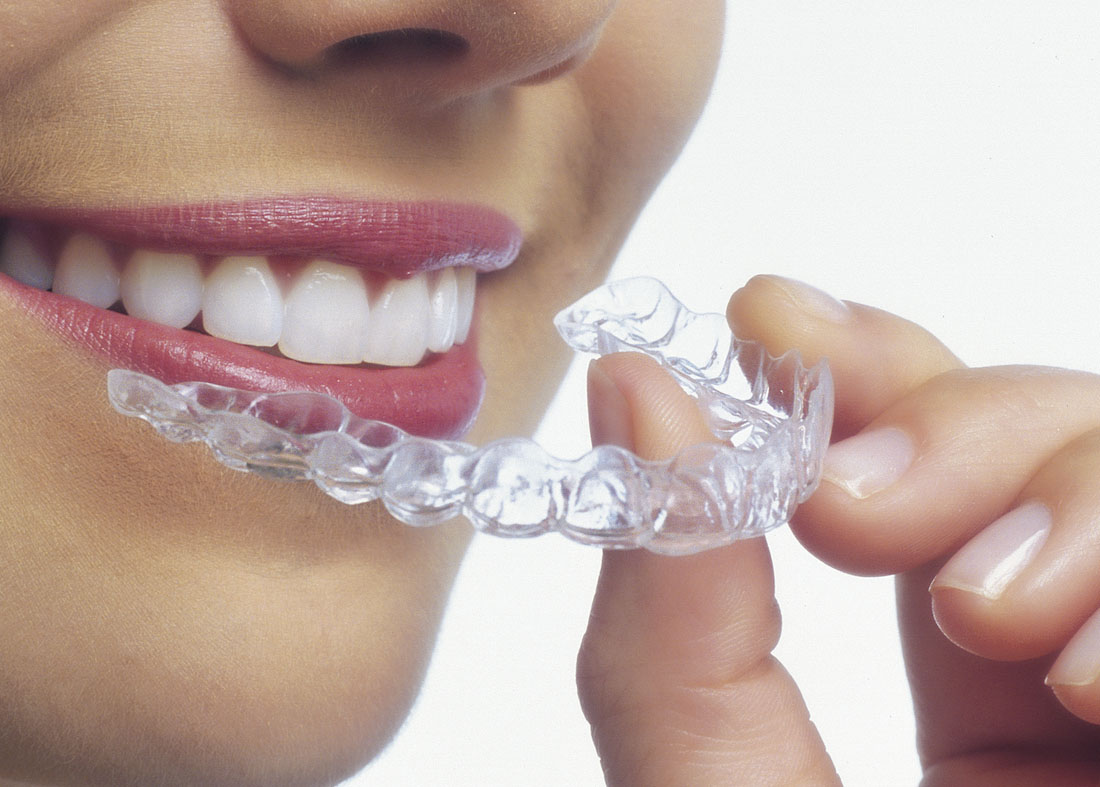 Ortodoncia Invisible Invisalign Madrid