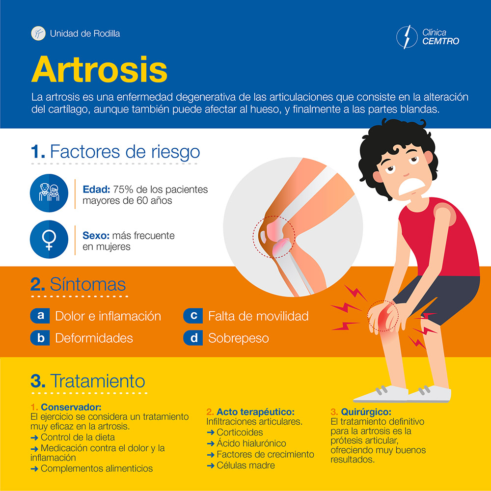 Artrosis de Rodilla - Vitalys Center Clínica de Fisioterapia