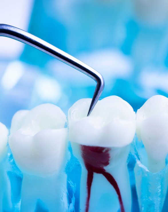 Endodoncia