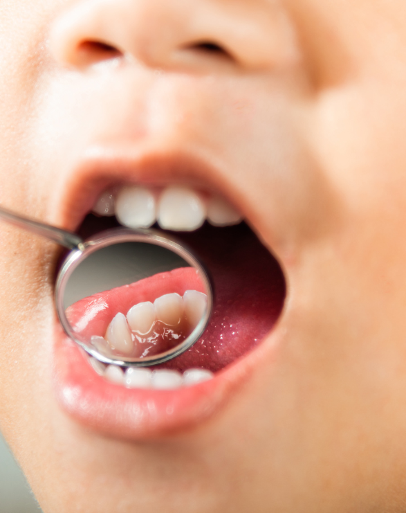 ODONTOPEDIATRIA